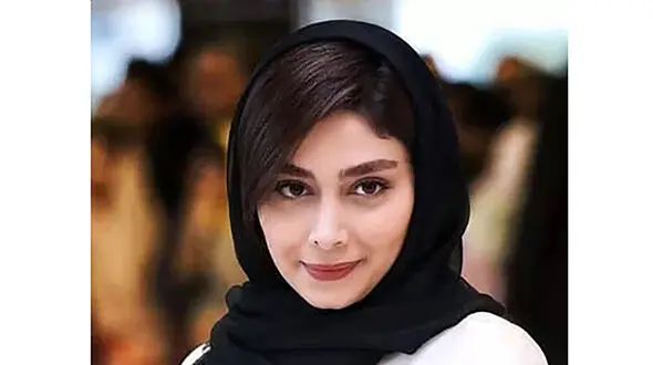 خانم بازیگری که 2 رنگ چشم دارد! / هر چشم یک رنگ!