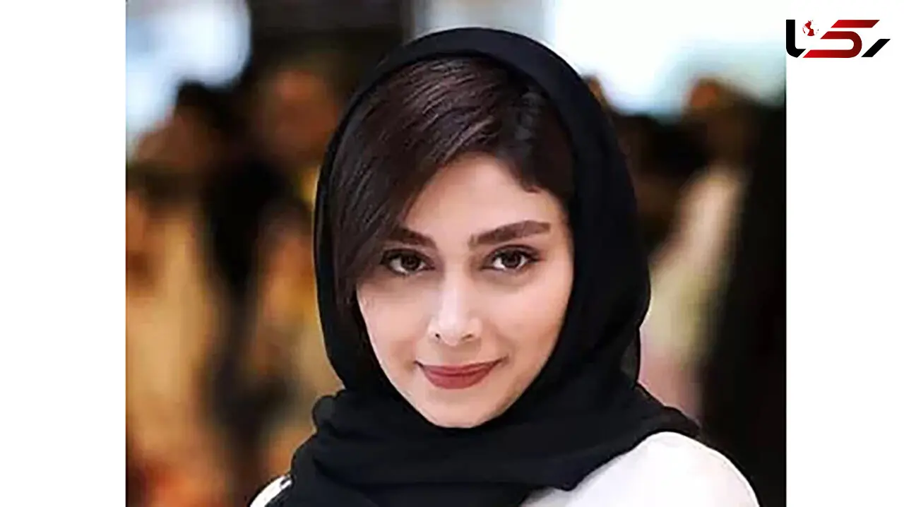 خانم بازیگری که 2 رنگ چشم دارد! / هر چشم یک رنگ!