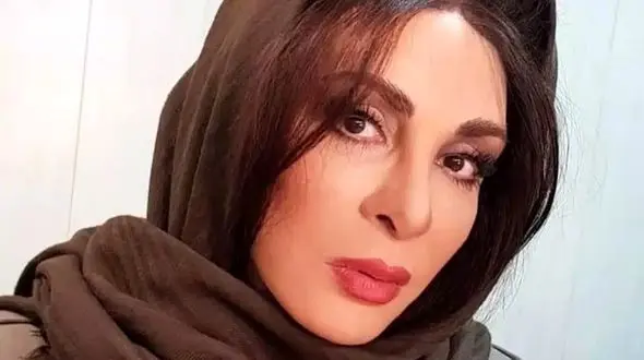  تغییر چهره عجیب افسانه بایگان / خانم بازیگر 20 سال جوانتر شد !