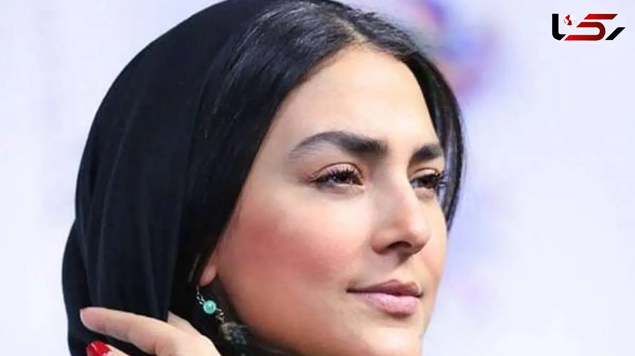 همه عمل های زیبایی هدی زین العابدین 