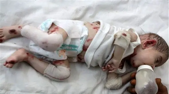 شناسایی ۳۶۷ بیماری نادر در ایران