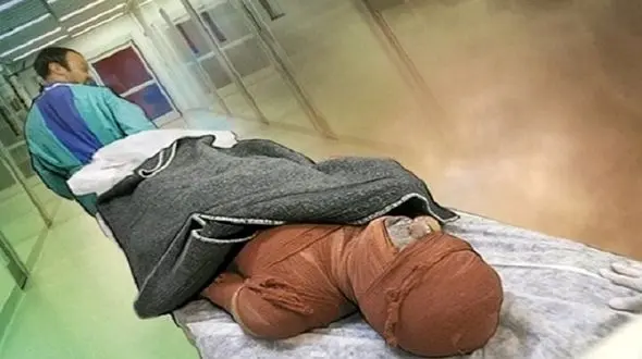 محاصره زن ایذه ای توسط آتش / بالگرد اورژانس پرواز کرد