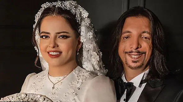 این عروس ایرانی جهان را تکان داد ! / ازدواج با داماد عجیب چهره  ! + عکس ها