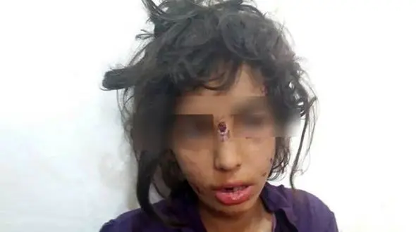 آزادی پدر و نامادری کودک آزار ماهشهری با فیش حقوقی ! + عکس