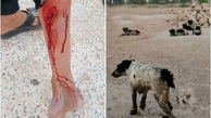 حمله سگ وحشی به نوجوان 13 ساله در امیدیه+ 16+
