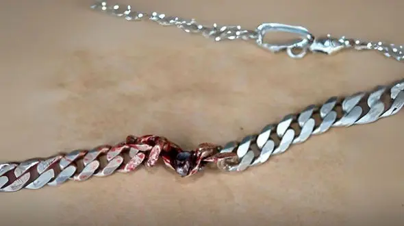 گردنبند تقلبی جان مردی را نجات داد / گلوله مرگ در گردنبند گیر کرد + عکس