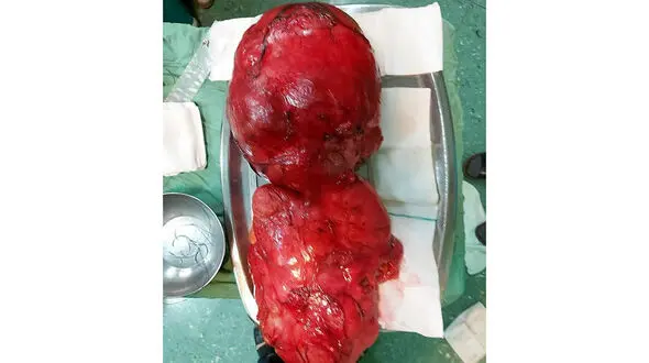 صحنه وحشتناک از شکم برآمده یک زن در نهاوند + جزییات