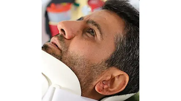 کتک خوردن کارشناس اورژانس قزوین او را تا پای مرگ برد + عکس مصدوم