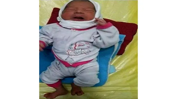 جیب خالی پدر برای درمان‌ نوزاد ۲۴ انگشتی 