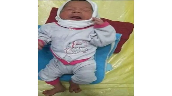 جیب خالی پدر برای درمان‌ نوزاد ۲۴ انگشتی 