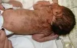 شمارش معکوس تخلیه ملک محل انجمن لوپوس با اخذ حکم دادگاه توسط شهرداری تهران و پیمانکار شهرداری
+ فیلم