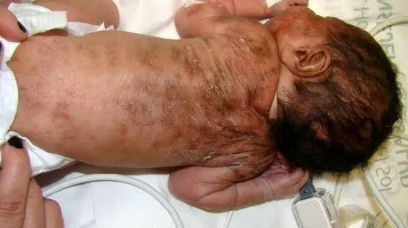 شمارش معکوس تخلیه ملک محل انجمن لوپوس با اخذ حکم دادگاه توسط شهرداری تهران و پیمانکار شهرداری
+ فیلم