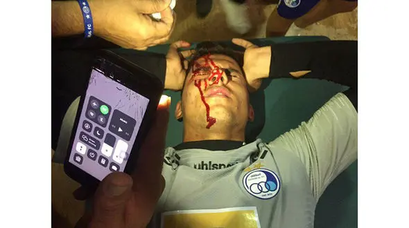 دوربین‌های امنیتی استادیوم‌ها که نمی‌بینند یا همه چیز را نمی‌بینند!