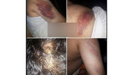 تصاویری از حمله خانواده دانش‌آموز شلاق خورده به معلم دبستان شهرستان کارون