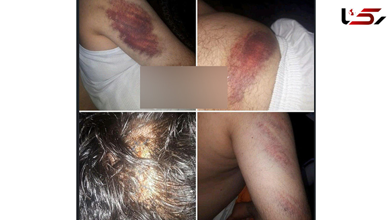 تصاویری از حمله خانواده دانش‌آموز شلاق خورده به معلم دبستان شهرستان کارون