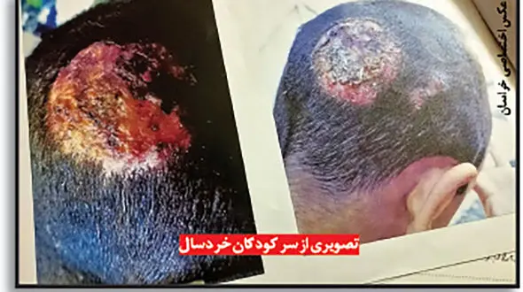 قصاب بی رحم گوشت الاغ به مردم می فروخت / کودک آزاری که پوست سر بچه هایش را کند + عکس 