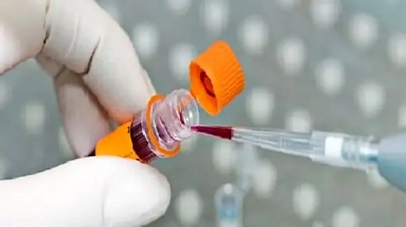 شناسایی 8 سرطان مهم با نوعی آزمایش خون جدید