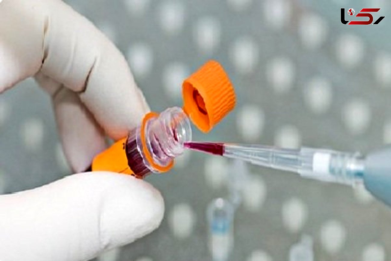 شناسایی 8 سرطان مهم با نوعی آزمایش خون جدید
