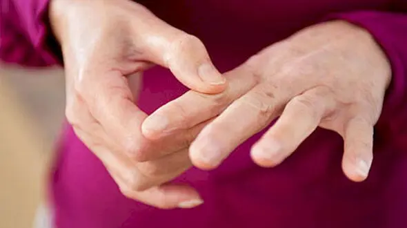 خشکی صبحگاهی بدن یکی از شایع ترین نشانه های ابتلا به آرتروز و روماتیسم 