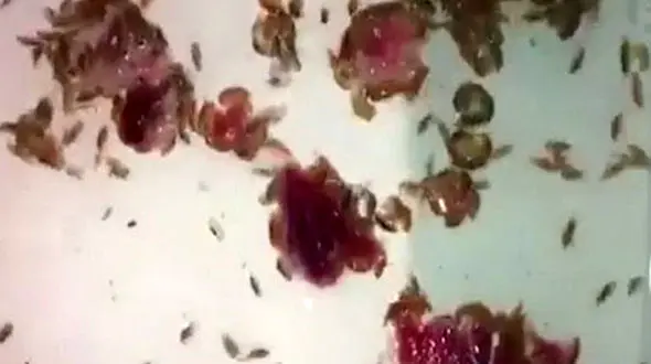 حمله وحشتناک  موجودات ریز  به پاهای نوجوان !+ عکس