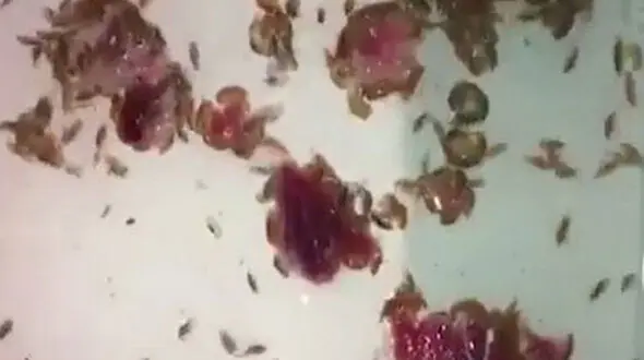 حمله وحشتناک  موجودات ریز  به پاهای نوجوان !+ عکس