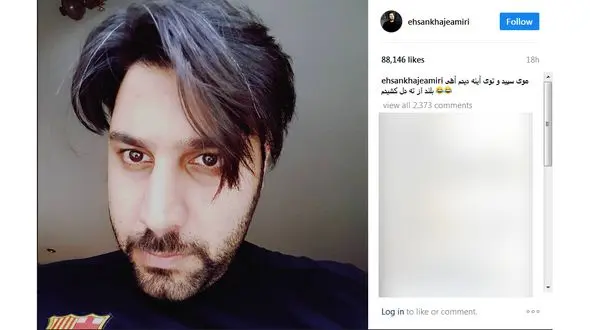 موی های خواننده معروف سفید شد + عکس