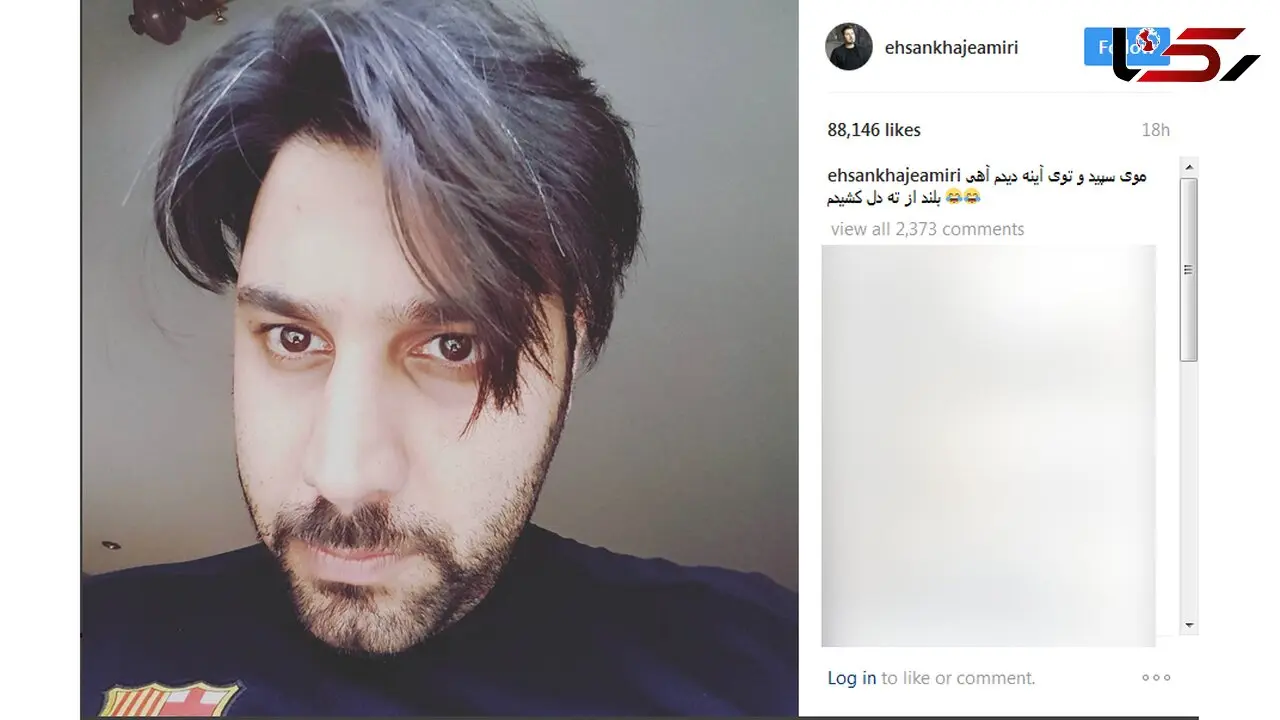 موی های خواننده معروف سفید شد + عکس