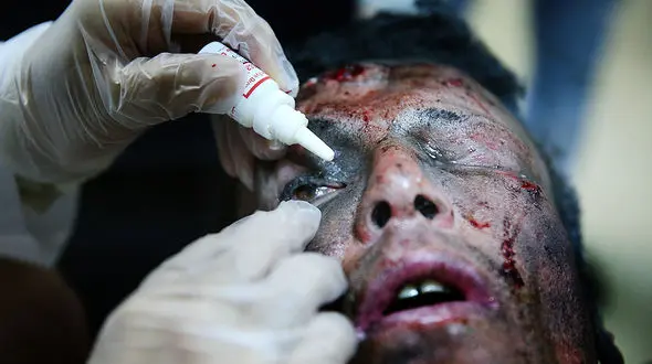 ۹۵ درصد سوختم، اما زنده ماندم / آتش نشان فداکار تهرانی چه گفت؟ + عکس