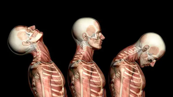 ترسناک ترین تصویر از بدن انسان / این بدن تصادف نمی کند!