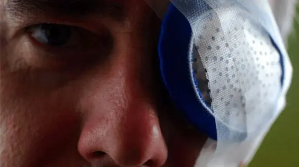 از بین رفتن قرنیه چشم ده ها ایرانی در 10 شهر + نامه رئیس انجمن چشم پزشکی ایران به غذا و دارو