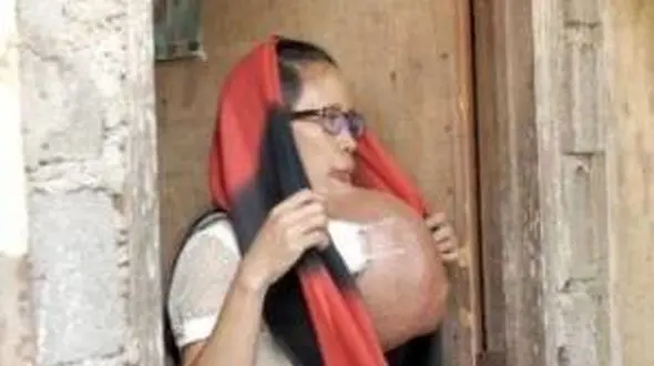 زندگی غم انگیز مادر جوان با چهره ای زشت! + تصاویر