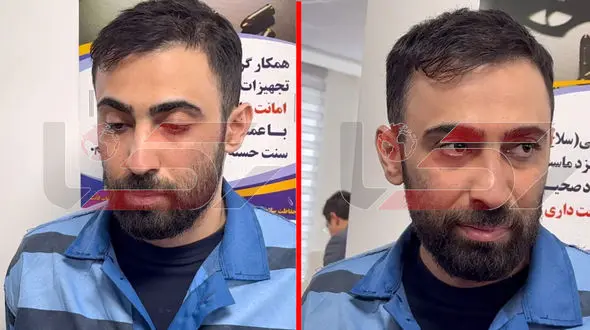 گفت و گو با جراح قلابی: من اتاق عمل نمیرفتم ... + فیلم