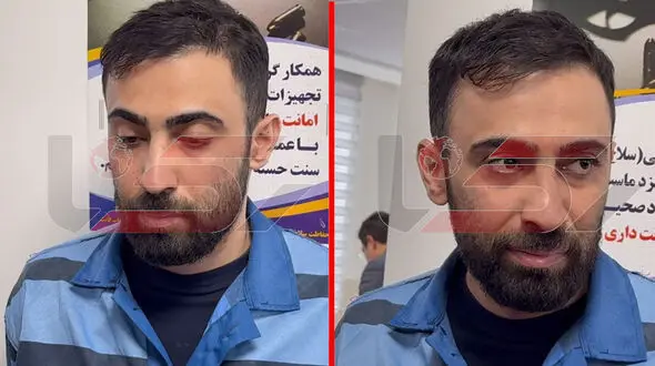 گفت و گو با جراح قلابی: من اتاق عمل نمیرفتم + فیلم