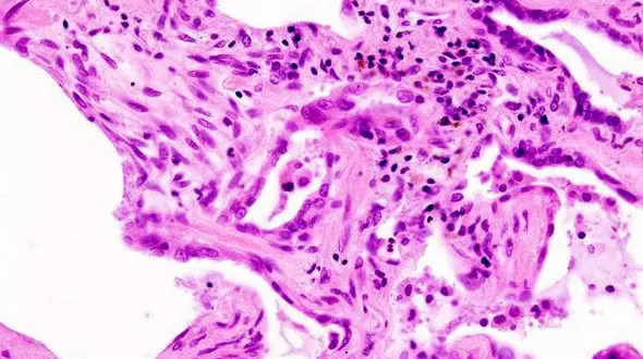 کلید درمان بیماری های لاعلاج در دستان یک پروتئین تازه کشف شده است