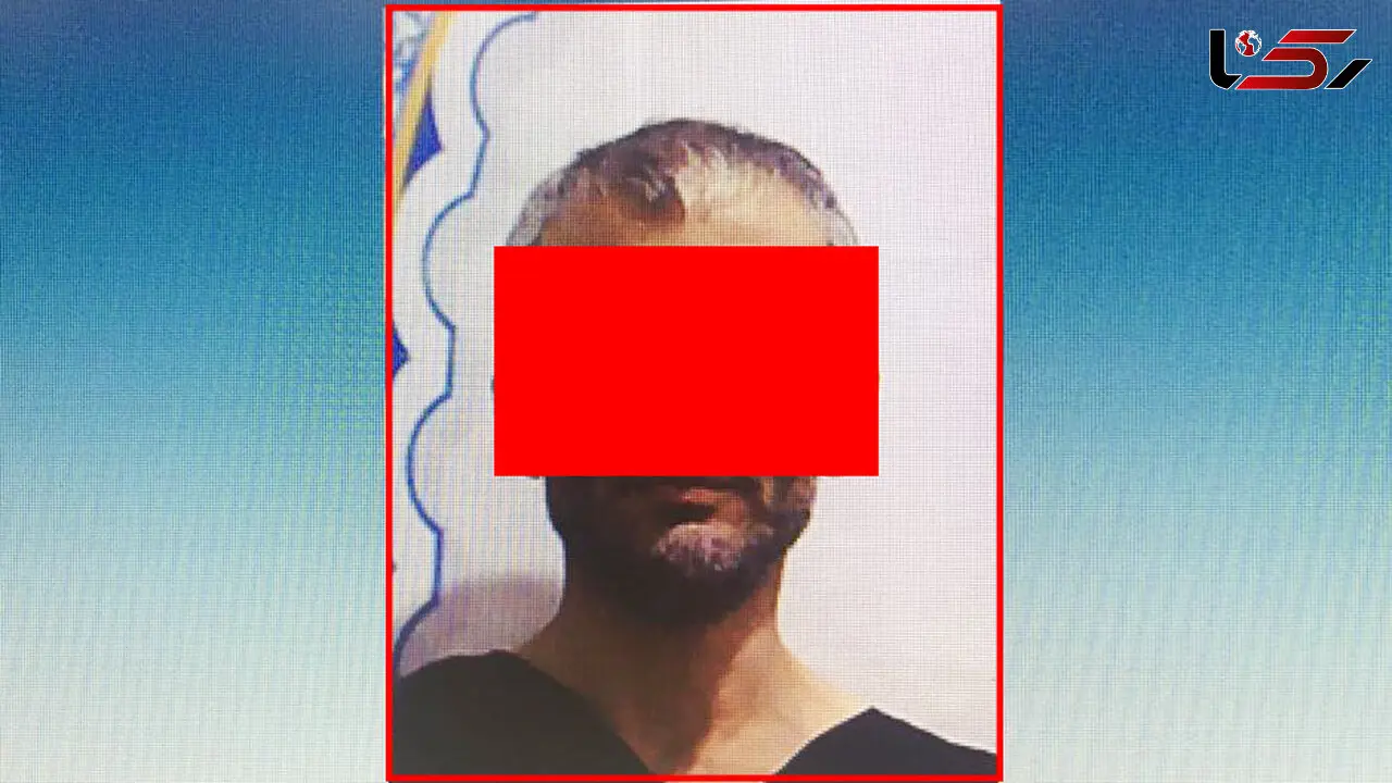  پسر گلو ، گوش و انگشتان پدرش را برید / در کرج رخ داد + عکس