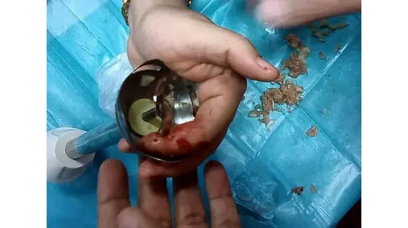 عکس گیر کردن انگشتان زن کاشانی در گوشت کوب برقی