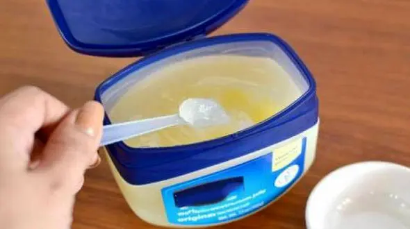 وازلین اگزما را تسکین می دهد