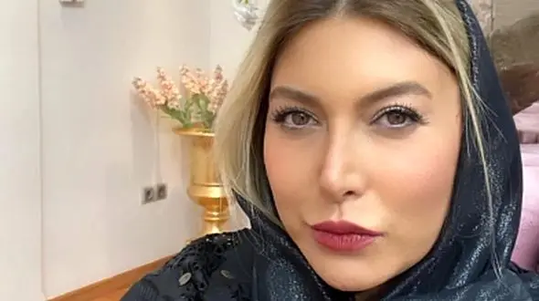 تصویر دیده نشده از فریبا نادری قبل از عمل زیبایی/  باور نمی کنید این اونه !