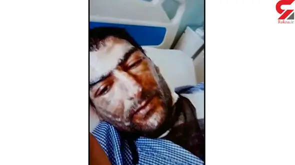 اسیدپاش فراری این فیلم دردناک بازداشت شد / این مرد تبریز را به شوک فرو برد + فیلم 