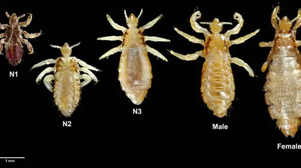 چگونه شپش را در خانه از بین ببریم؟