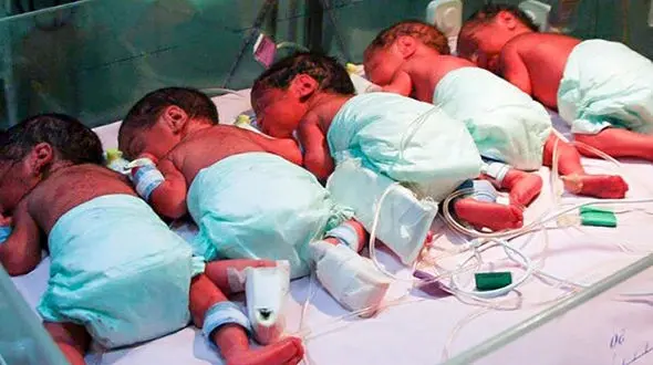 فیلم دیدنی از پنج قلوهای زن شیرازی/ جمعه متولد شدند!