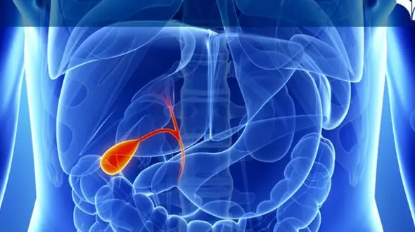 راه های پیشگیری از پر شدن کیسه صفرا