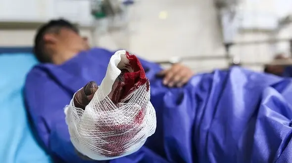 قطع هر دو دست یک مرد  در دورود‌