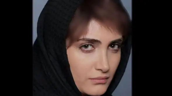 غوغای زیبایی پسرکش الناز ملک با این پوشش باز/جذابیت استایل و چشم های رنگی الناز ملک! 