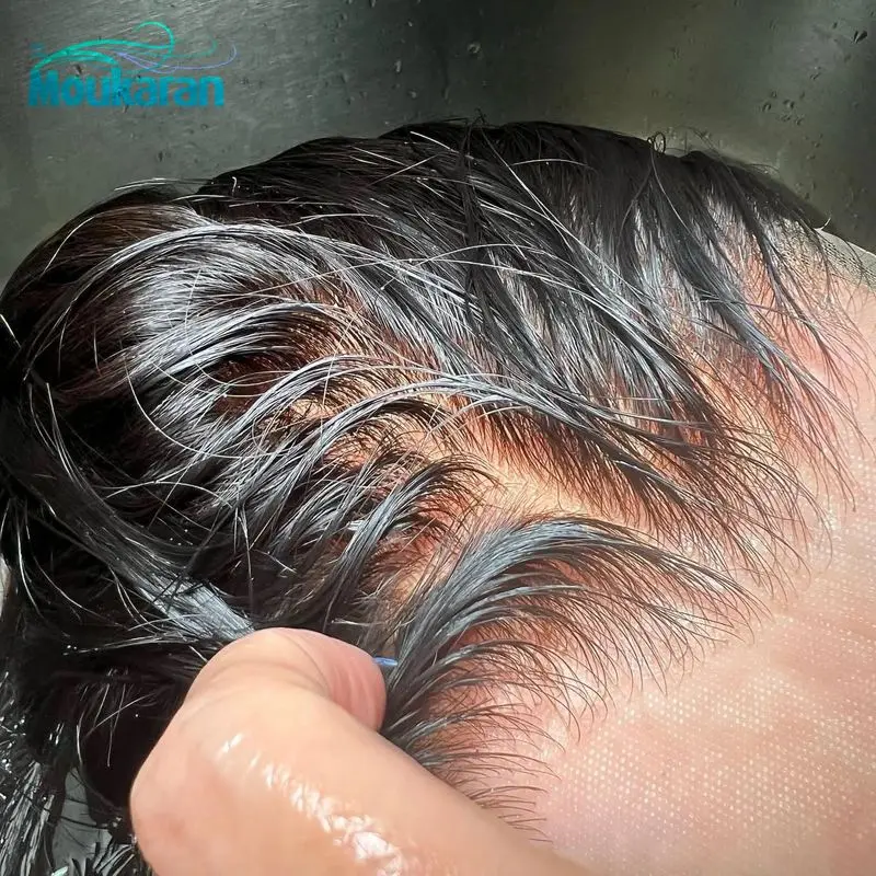 پروتز مو اورجینال