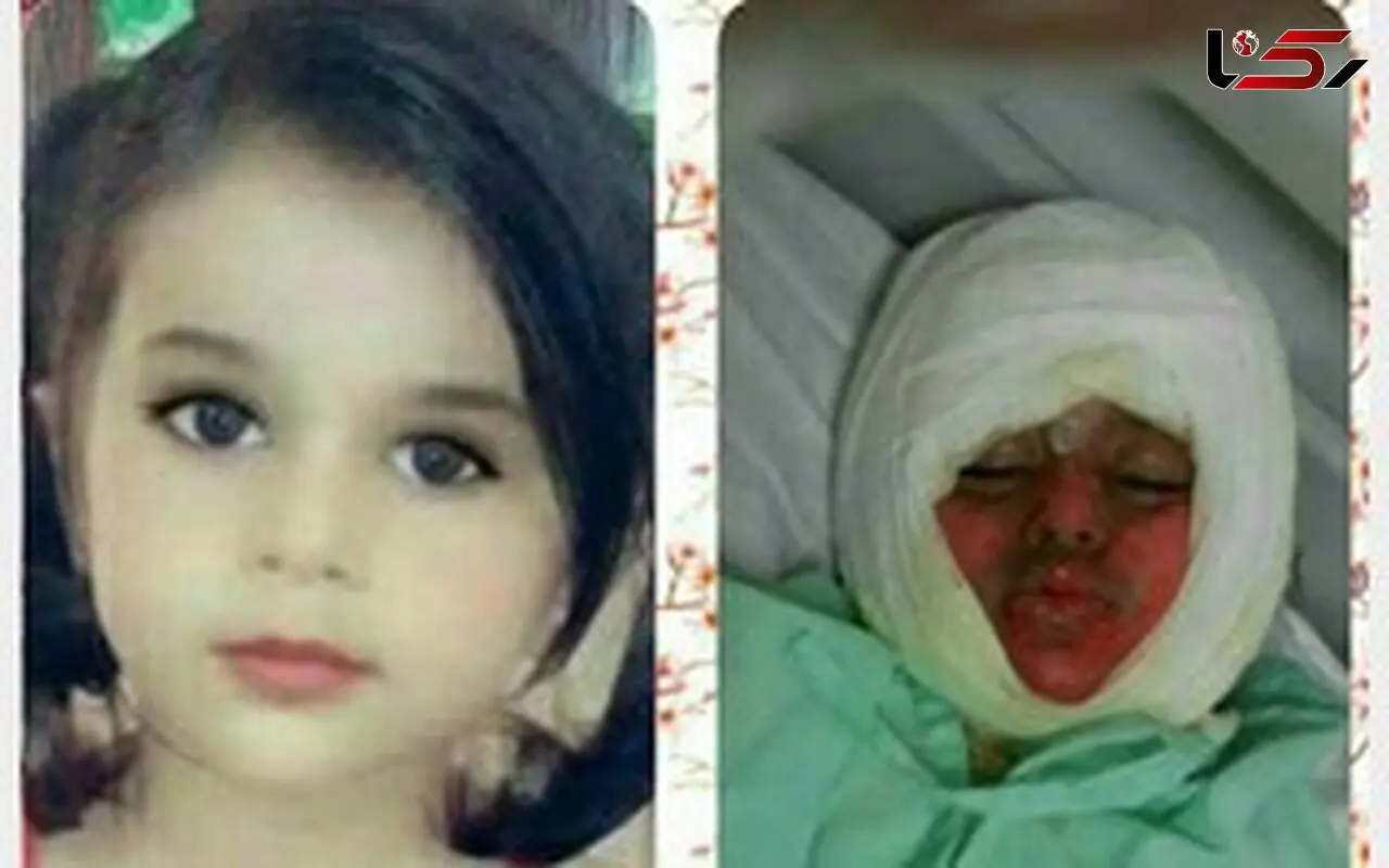 عکس دختر بچه زیبایی که در دیگ خورشت نذری افتاد و فاجعه رخ داد