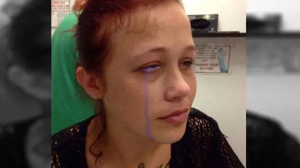 این دختر با اشک بنفش گریه می کند/ تاتو چه بر سر دختر زیبا آورد +عکس