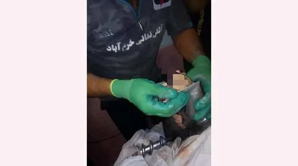 چرخ شدن دست کودک 4 ساله در خرم آباد + عکس ها