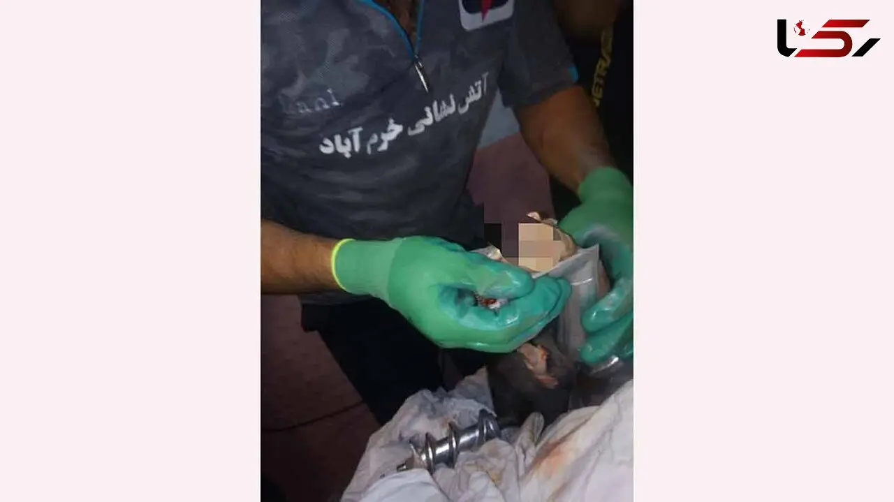 چرخ شدن دست کودک 4 ساله در خرم آباد + عکس ها
