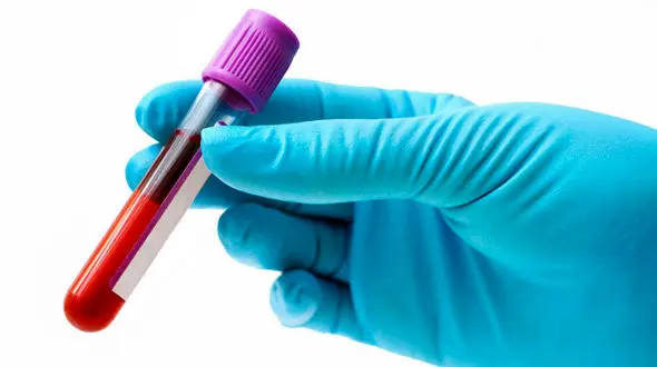 خون مصنوعی اختراع شد